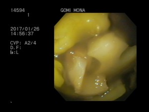 20170126_145702.996625